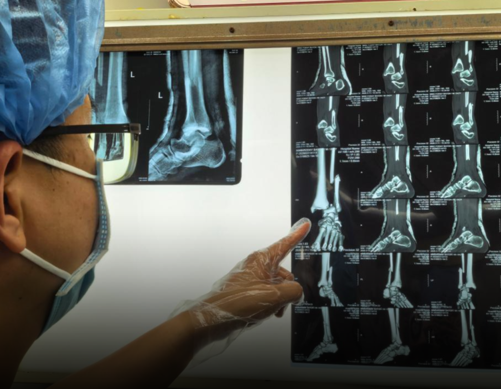 Chinese Medical Team in Sierra Leone Saves Patient from Amputation